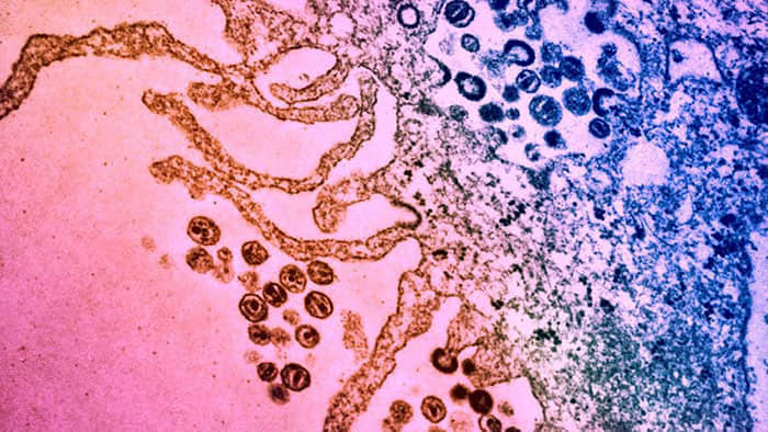 抗生素分子帮助免疫系统杀死HIV感染的细胞 -1 抗生素分子帮助免疫系统杀死HIV感染的细胞-NICEGAY
