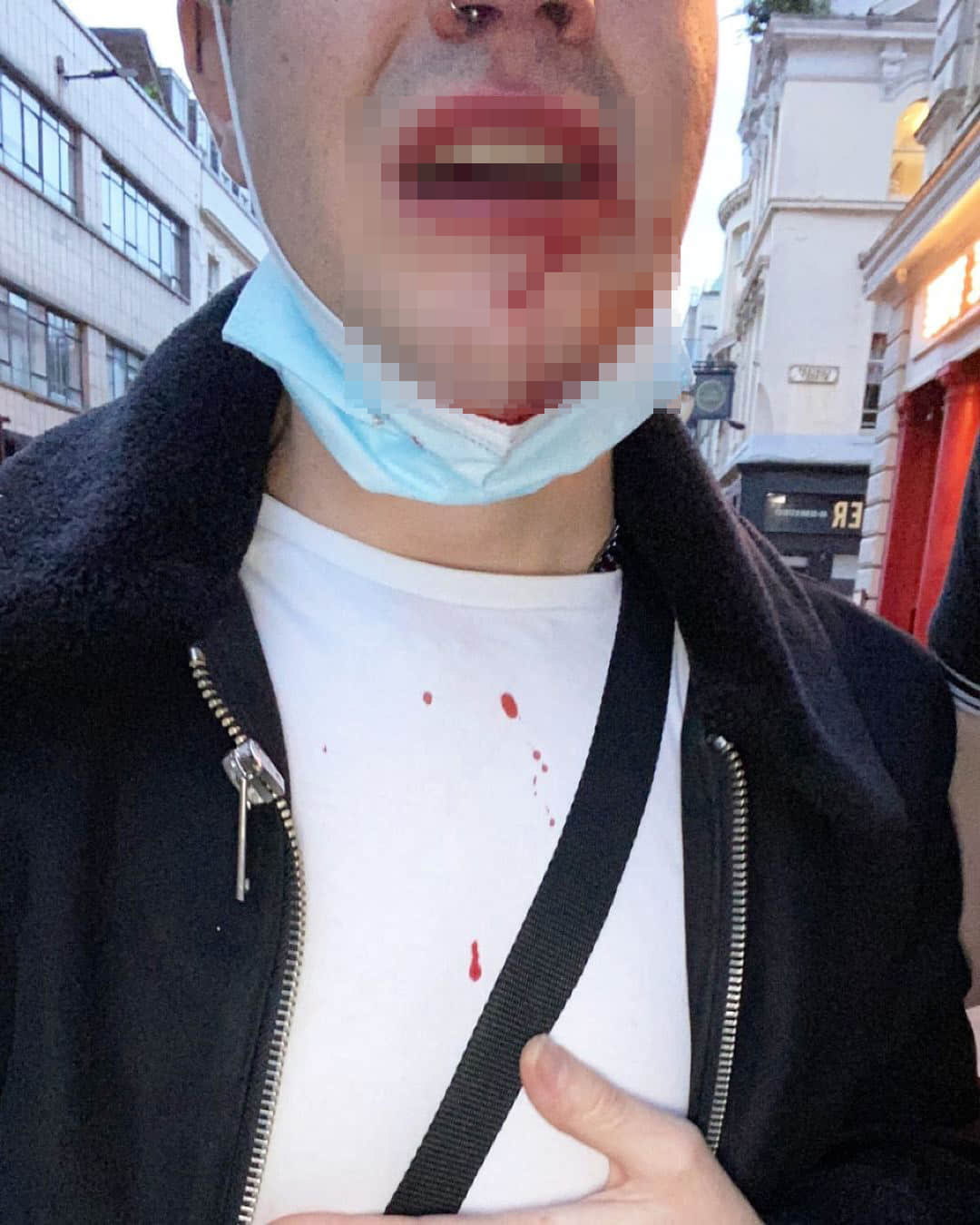 英国一周三起恐同袭击事件 利物浦犯罪委员会严正表示「不能接受」-NICEGAY