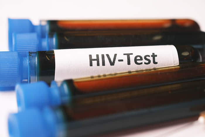 HIV 患者經幹細胞移植後痊癒 科學家挖掘治癒關鍵!-NICEGAY