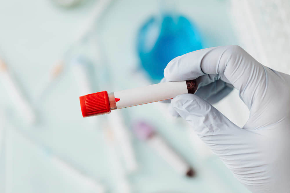 全球第 6 位 HIV 患者幾近痊癒! 科學家驚:「至今已逾一年半未復發。」-NICEGAY