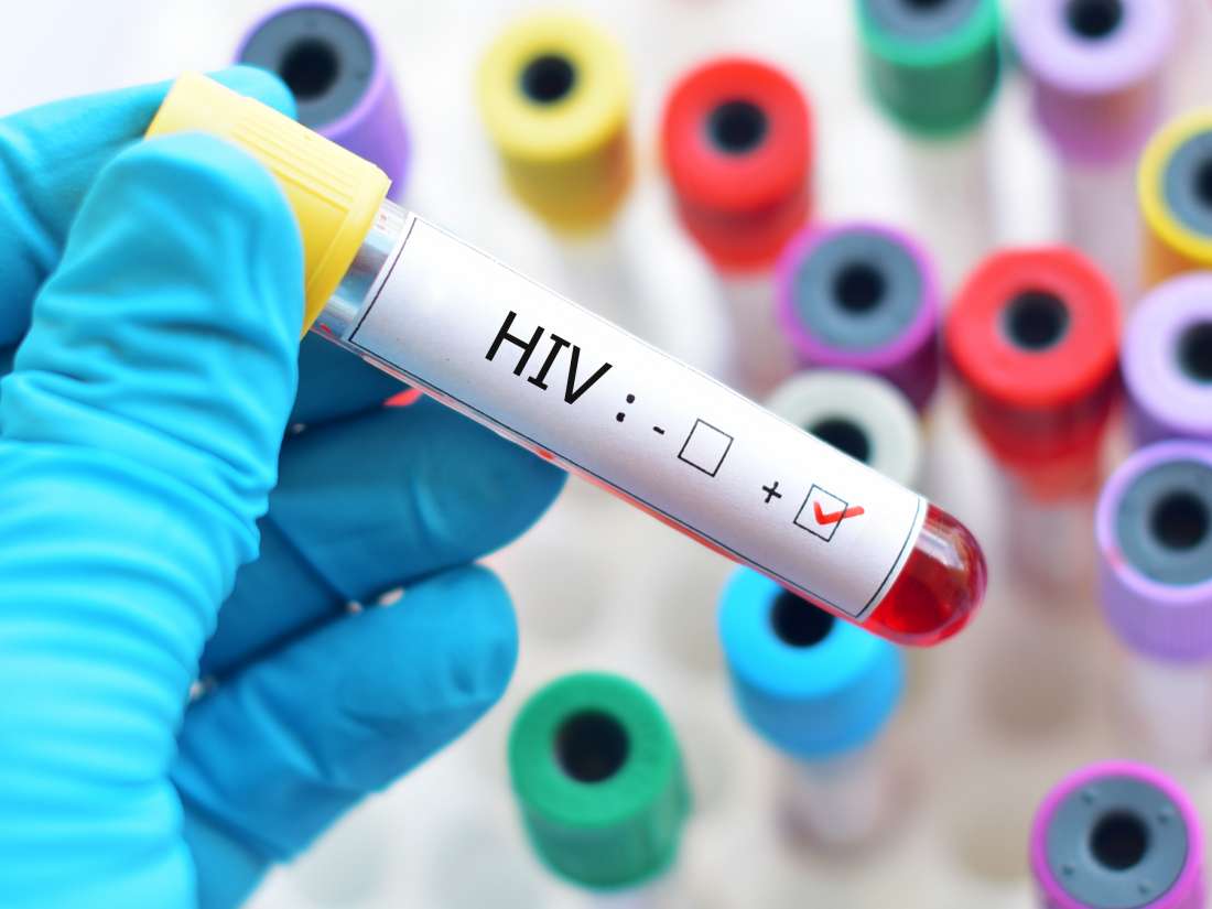 醫生憂 HIV 汙名化:患者病毒量低到不具傳染力,但他們仍擔心…-NICEGAY